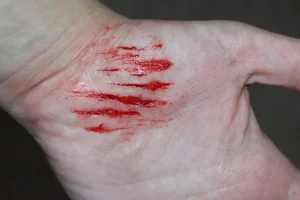 ForensicFX Studios Thin Cuts Prosthetic Bundle> Halloween Accessories