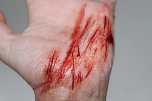 ForensicFX Studios Thin Scrapes Prosthetic> Halloween Accessories