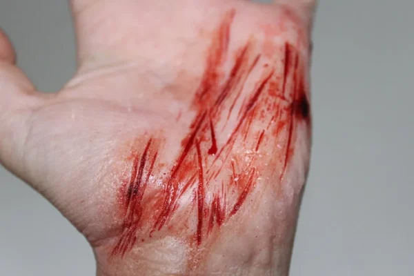 ForensicFX Studios Thin Scrapes Prosthetic> Halloween Accessories