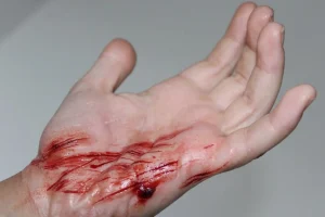 ForensicFX Studios Thin Scrapes Prosthetic> Halloween Accessories