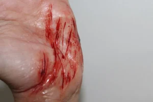ForensicFX Studios Thin Scrapes Prosthetic> Halloween Accessories
