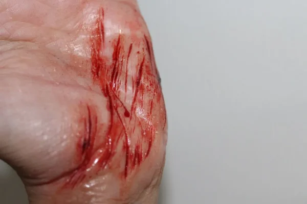 ForensicFX Studios Thin Scrapes Prosthetic> Halloween Accessories