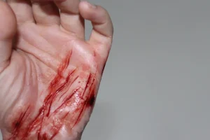 ForensicFX Studios Thin Scrapes Prosthetic> Halloween Accessories