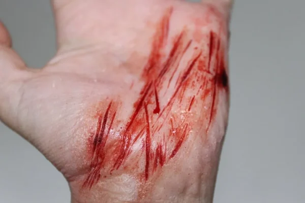 ForensicFX Studios Thin Scrapes Prosthetic> Halloween Accessories