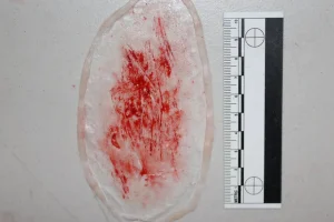ForensicFX Studios Thin Scrapes Prosthetic> Halloween Accessories
