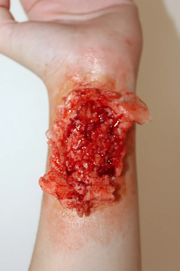ForensicFX Studios Torn Wrist Prosthetic> Halloween Accessories