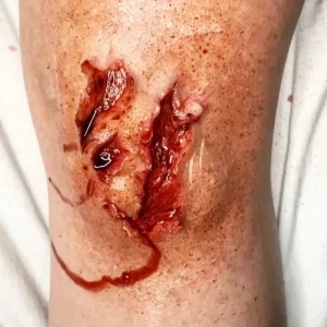 ForensicFX Studios Trauma Wounds Prosthetic Bundle> Halloween Accessories