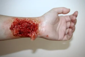 ForensicFX Studios Trauma Wounds Prosthetic Bundle> Halloween Accessories
