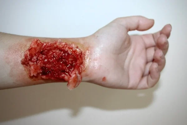 ForensicFX Studios Trauma Wounds Prosthetic Bundle> Halloween Accessories