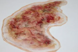 ForensicFX Studios Zombie Face Burn Prosthetic> Halloween Accessories